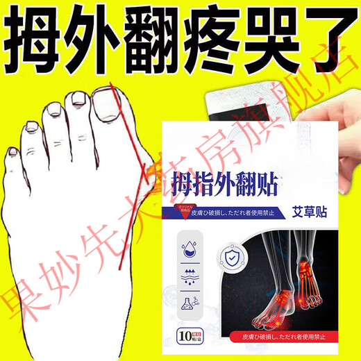 
Toe deformity with thumb valgus on the inner court, big thumb pain bunion joint pain, redness and swollen toes overlapping forefoot pad I am a manufacturer direct sales [15,685 pieces sold in the event] Buy 3+2 (buy this) and send 5 boxes