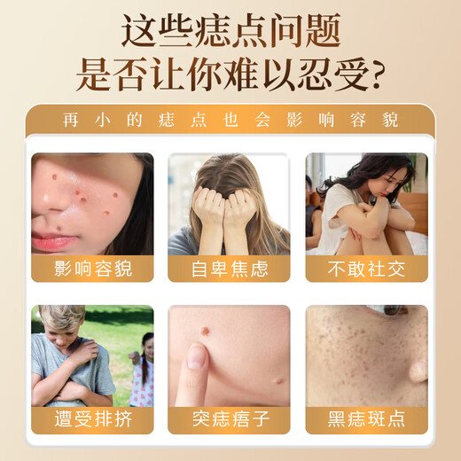 Dr. Mo's Hong Kong Pharmacy Mole Spot and Mole Removal Cream, No Scars on the Face, Black Mole Painless Repair Solution, Available for Children