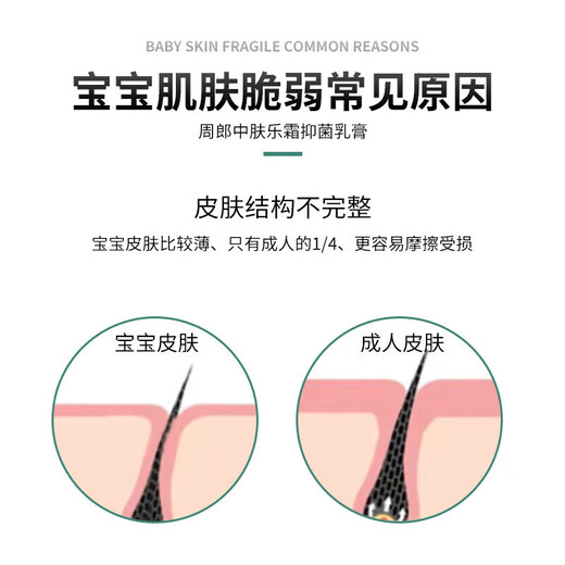 DAGO baby eczema cream, special antibacterial and anti-itching cream for children, Nobixing newborn saliva lip and hip protection cream 1 piece