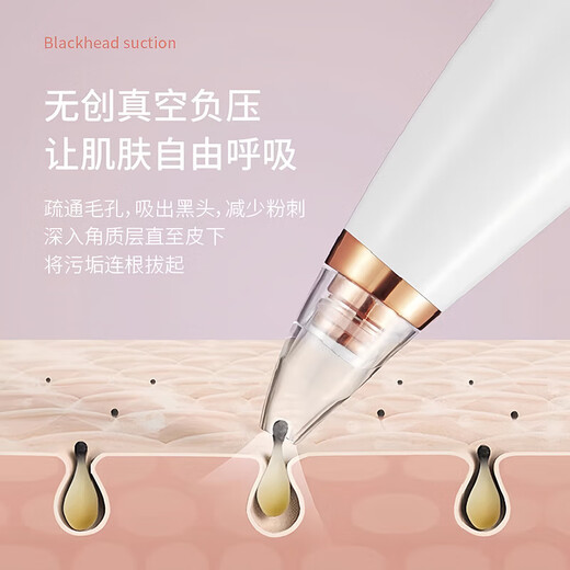 Blackhead Suction Device Blackhead Cleaning Magic Blackhead Suction Device Facial Small Bubble Cleaner Instrument Deep Acne Pore Blackhead Removal Beauty Device Gift for Girlfriends Fully Equipped with Rechargeable Powerful Suction + Deep Cleansing + Blackhead Removal in Seconds