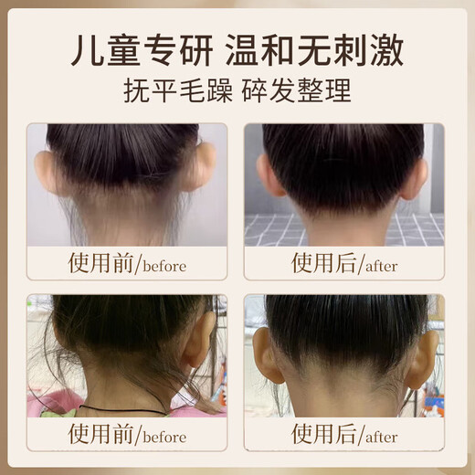 Youduolian Camino de afeitar el cabello Artefacto para el cabello para niñas y el examen de grado de peatillo roto para niñas