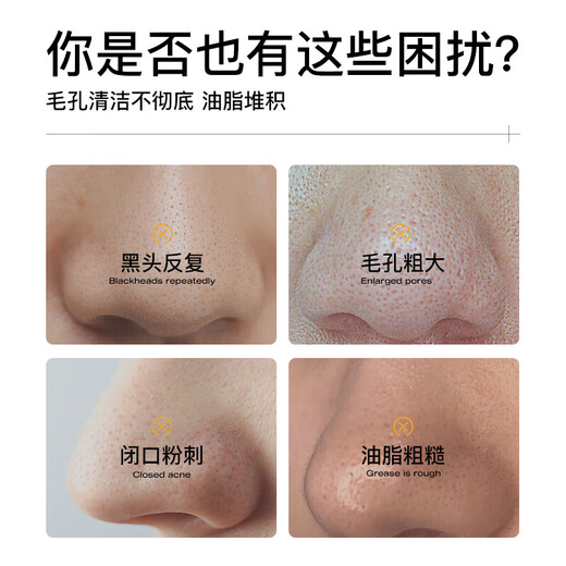 Renhe Handwerkskunst Pull-Tip Blackhead Maske 150 g Schrumpfung Porenporen-Poren-Poren-Poren-Paste mit Feuchtigkeitsfeuchtigkeitsfeuchtigkeitsfeuchtigkeitsfeuchtigkeitsfeuchtigkeitsfeuchtigkeitsfeuchtigkeitsfeuchtigkeitsfeuchtigkeitsfeuchtigkeitsfeuchtigkeitsfeuchtiger feuchtigkeitsspendende Feuchtigkeitsmaske für die tiefe Reinigung für Männer und Frauen