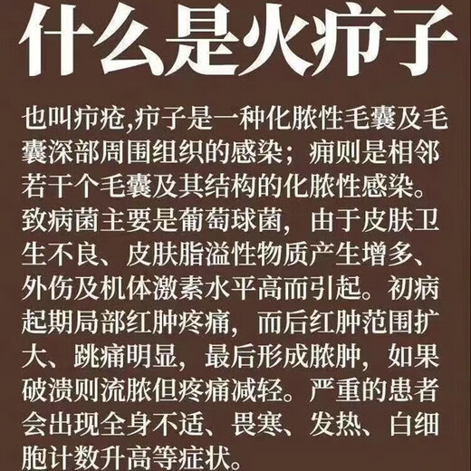 Fire boil ointment for pimples on the back of the neck, white hard lumps, pustules, redness and pus, gas pimples, acne, hard fat lumps, cysts, sores, small area burns, skin disease medicine, erythromycin ointment 1 box