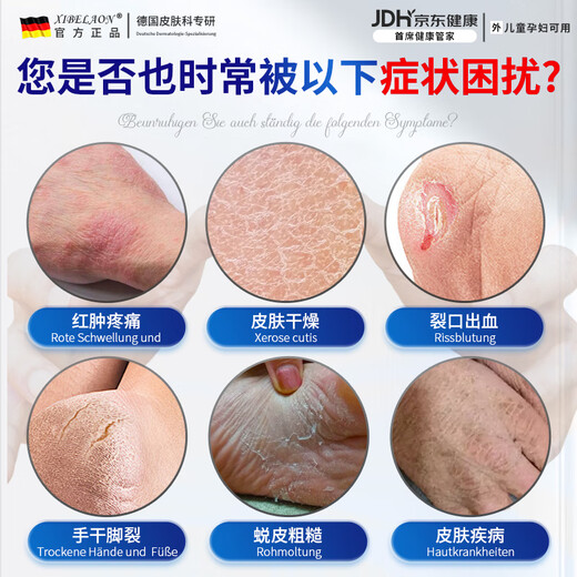 XIBELAON Cracked Foot Cream Heel Anti-Dry Cracked Bleeding Chapped Cracks Frosted Cracked Horse Oil Cream Protects Hands, Feet, Hands and Feet Moisturizing Cream