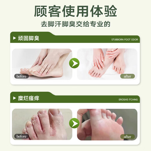 Jibu Pharmaceutical Foot Wash, deodorizing, sterilizing and removing athlete's foot, smelly feet, sore feet, sweaty feet, foot rub and special odor removal