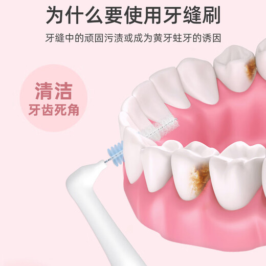 Fawn Mama Rulong 2 L-shaped interdental brush ssss*20 pieces directly attack deep tartar and clean teeth interdental brush (reusable)