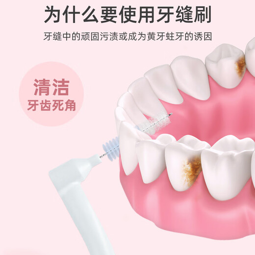 Xiaolu's mother imported interdental brush orthodontic toothbrush cleaning teeth interdental brushing gap brush 20 pieces 0.7mm 10 pieces 2 bags