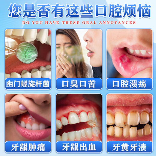 葵花幽门螺旋杆菌牙齿口气清新剂去口臭专用双效除菌口腔抑菌膏 【买2送1】葵花幽门牙膏 【三盒一疗程，推荐按周期使用】