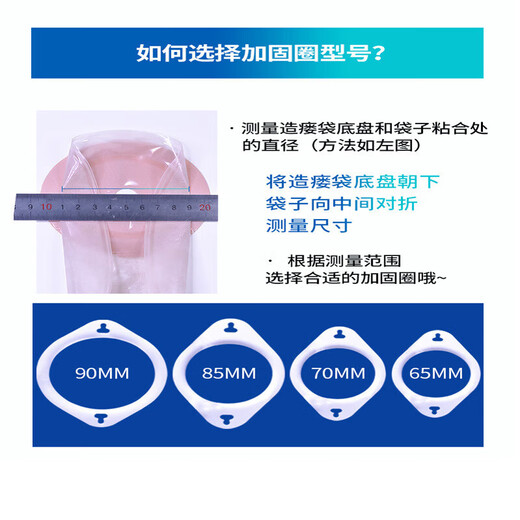 念顷（念顷爱 汇成海）造口加固腰带地盘尿路肛肠通用造口弹力加固带造瘘袋护理附件念顷 9207/二件式造口腰带/腰带/1条