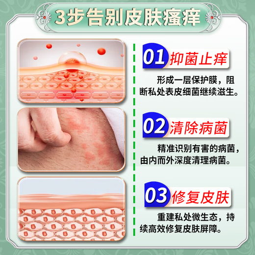 Peking Union Medical College, anti-itch, anti-bacterial, skin itching, body itch relief, 100% effective eczema, fungal infection, rash allergies, no recurrence, a box of Japanese anti-itch spray, no recurrence of eczema rash