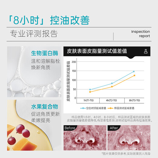 ILSO Blackhead de exportación Esencia Blackhead Agua del acné Whitehead Cerrado de la limpieza profunda El equilibrio del aceite de limpieza profunda Dispara 150G