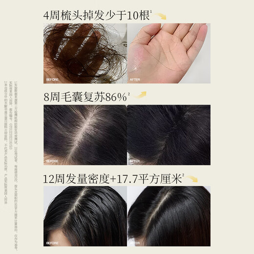 Pu Zhi Purzeal Mulin Sichuan Ingwer Anti-Verlust-Shampoo starke, feste und wütende Haarölkontrolle Flauschiger Shampoo 400 ml
