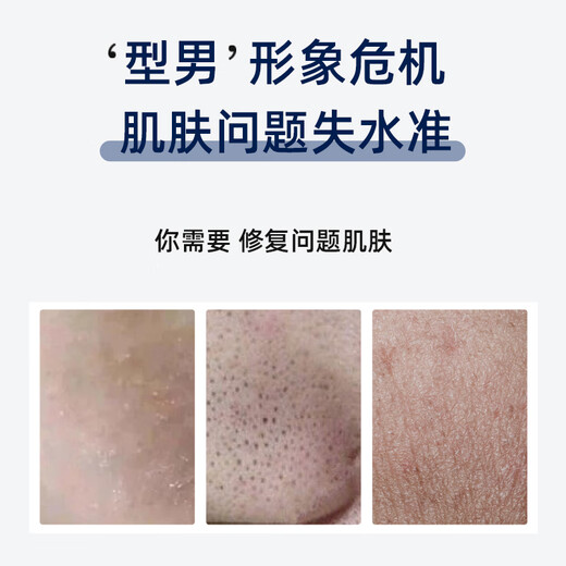 VE Facial Mask for Acne Clearing and Whitening Mask for Men and Women, Moisturizing, Whitening and Lightening Acne Clearing VVE Men's Facial Mask 18 Pieces/Three Boxes [Whitening and Acne Clearing Mask]