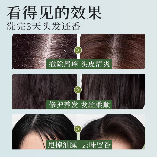 
Amalisa shampoo for men and women (oil control, fluffy, anti-dandruff, anti-itching and itchy shampoo, long-lasting fragrance) 780g
