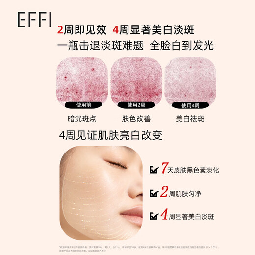 Yuli (EFFI) official authentic whitening and freckle removal cream without makeup cream whitening and brightening freckle removal concealer light melanin beauty cream for women whitening and freckle removal cream 15g