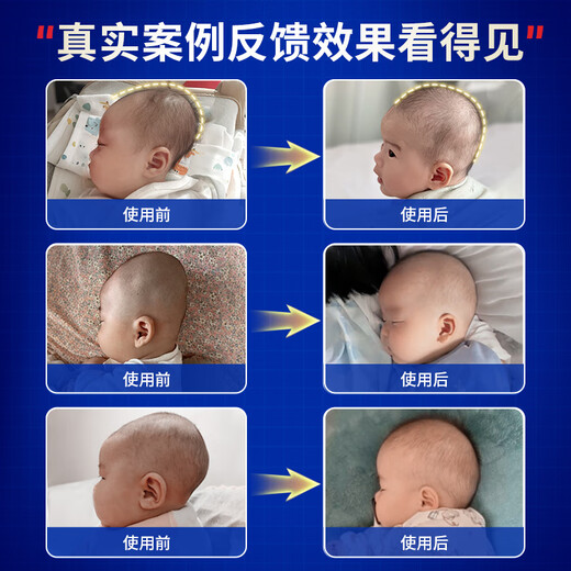 Colorful Doctor Baby Pillow Setting Pillow Anti-Version Correction Head Type 0-6-12 Months Correction Newborn 1-year-old baby pillow
