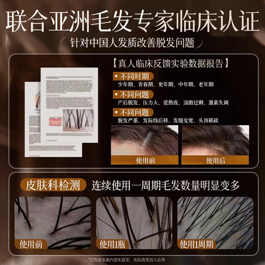 XIXIA CHENGUANG French Anti-Depletion Champú para el crecimiento del cabello especial de los hombres y la crema acondicionadora de cabello para mujeres Pangdonglai Jengibre y crecimiento del cabello Líquido de cabello denso