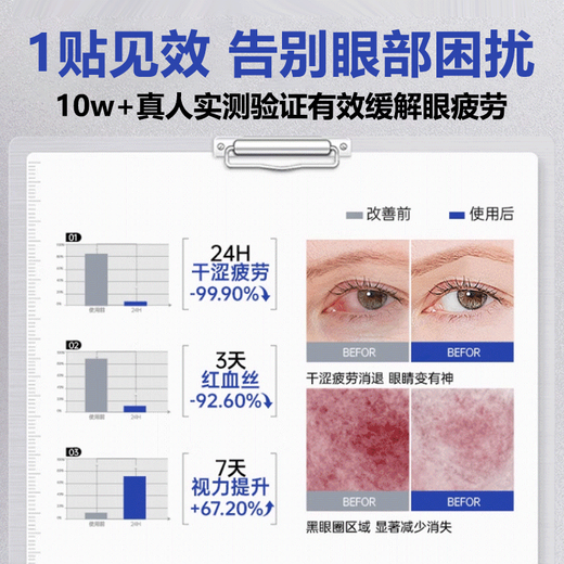 British drops of lutein steam eye mask 30 pieces hot compress eye mask to relieve eye fatigue and swelling eye care