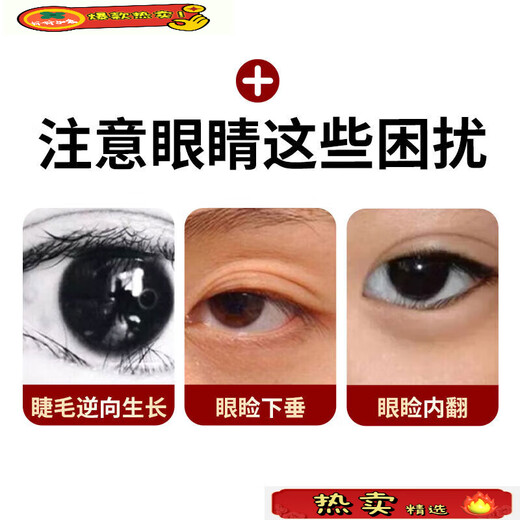 The official flagship of the ancient and modern inverted eyelash patch for children and infants, the magic tool for lower eyelid trichiasis ectropion and lifting, 3 boxes of treatment packages for severe inability to open eyelashes inverted, Fat Donglai online supermarket