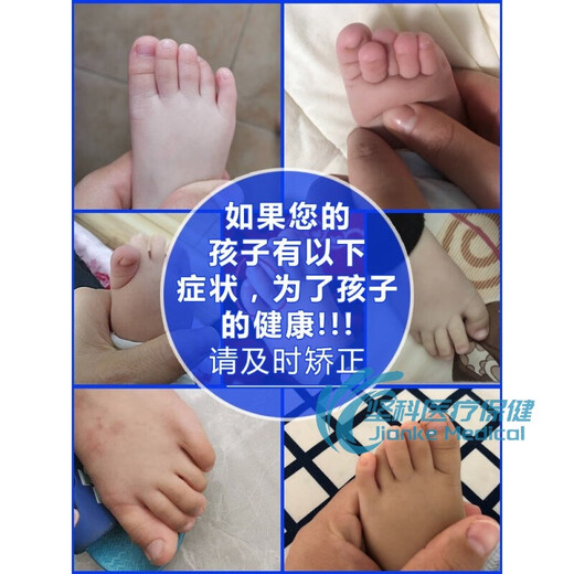 【JD健康】婴儿童脚趾头小孩大拇指外翻矫正器宝宝重叠分离器分趾母内扣821+食+中(2-9岁)均码 831大拇指+食指+中指(1-4岁)