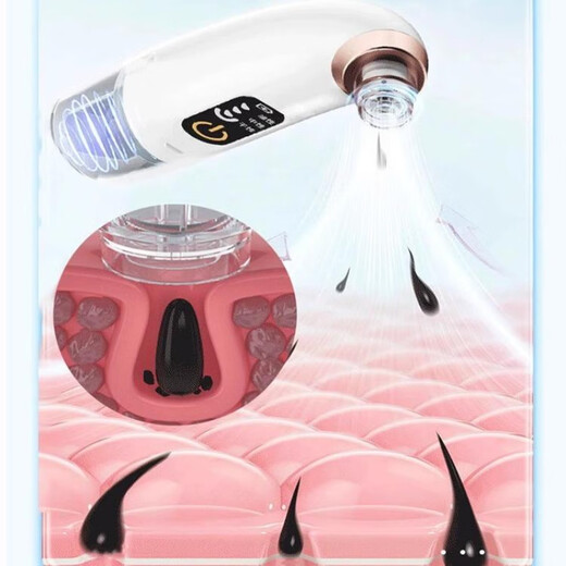 DIKTT Germany blackhead suction instrument cleaner for beauty salons, dedicated for home use with large suction, electric small bubbles, pore cleaning and hydration, sucking out acne and facial blackhead cleaning artifact. Luxurious model + intelligent movement + gentle water suction + second suction of blackheads and acne + oxygen injection and hydration. Fully equipped / 80 million negative ions + 4-level adjustment + more lasting