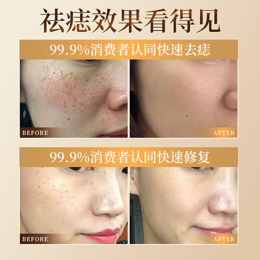 Dr. Mo's Hong Kong Pharmacy Mole Spot and Mole Removal Cream, No Scars on the Face, Black Mole Painless Repair Solution, Available for Children