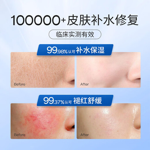 BEAIB5积雪草面膜补水保湿晒后修复敏感抗皱紧致熬夜提亮肤色男女*3