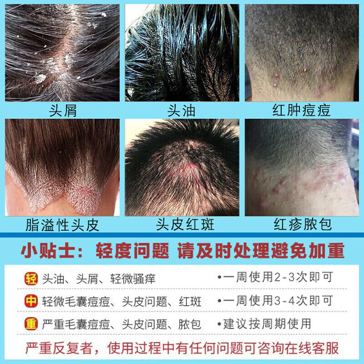 南京同仁堂氨基酸洗发水毛炎宁去屑止痒控油毛囊专用头皮深层清洁护理500ml
