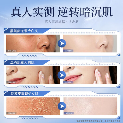 Honda Pharmaceutical Niacinamide Gel Medical Whitening, Spot Removal and Melanin Spot Niacinamide Gel for Men and Women 3 Boxes