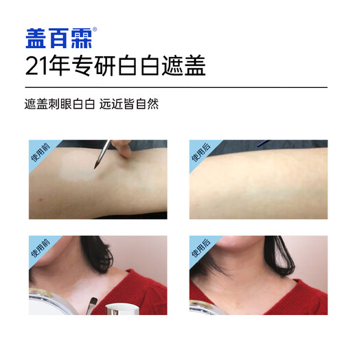 Gai Bailin White Spot Covering Liquid Vitiligo Covering Liquid Skin Color Covering External White Spot Covering Waterproof and Sweatproof Small Blue Bottle Waterproof Small Blue Bottle Facial Equipment (Face, Neck, Limbs and Trunks)