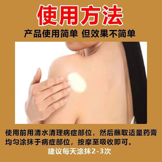 Fire boil ointment for pimples on the back of the neck, white hard lumps, pustules, redness and pus, gas pimples, acne, hard fat lumps, cysts, sores, small area burns, skin disease medicine, erythromycin ointment 1 box