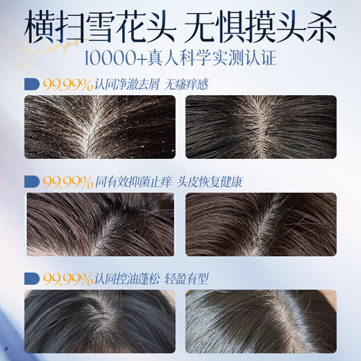 Korean grain selenium disulfide shampoo, anti-dandruff, anti-itch, oil control, fluffy hair follicles, men's and women's shampoo, head cream 500ml