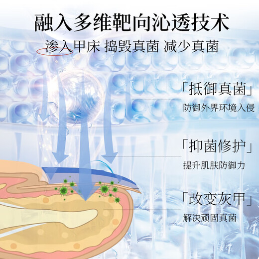 Tongrentang Onychomycosis Special Nail Fungus Infection Removal, Bad Nails, Bright Nails, Onychomycosis, Net Yellowing, Thickening and Empty 30ml