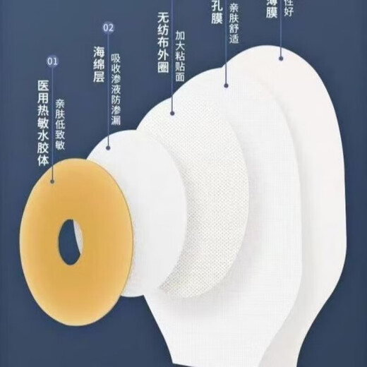 Medical Shengshu One-piece Ostomy Rectal Cancer 15251 Ostomy bag Fecal stool and feces stool pocket Kanglebao same model + fast exhaust valve [domestic substitution 10 pieces [1 box] Velcro patch pocket