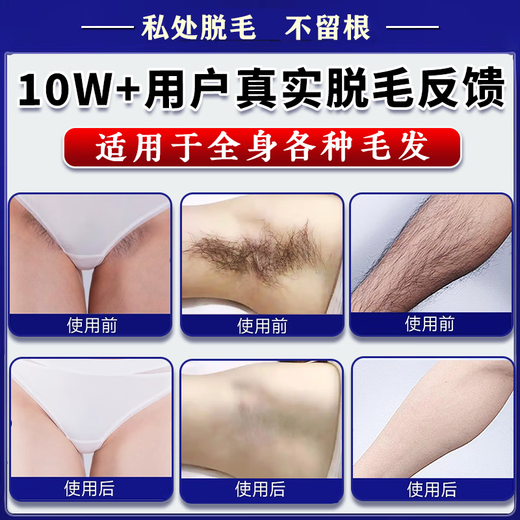 ZKYO Hair Removal Cream is a permanent hair removal product for private parts that will no longer grow. It is specially designed for men and women with beards, armpits, pubic legs, and anus. Single box. It can be used for hair all over the body. Powerful hair removal for private parts, lips, face, limbs, can be used all over the body.