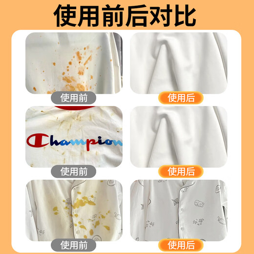 XINUO Clothes Grease Cleaner 200ml Biological Enzyme Oil Remover Collar Remover Yellow, Oil and Contamination Magic Device