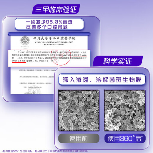 Colgate 360 Multi-effect Care Toothpaste Gum Protection Contains Fluoride, Anti-moth, Fresh Breath, Removes Dental Plaque 180g, Essence Gum Care