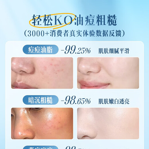 Korean herbal grain anti-mite soap medicinal handmade soap sulfur bath bath face wash 72H long-lasting fragrance soap for men and women