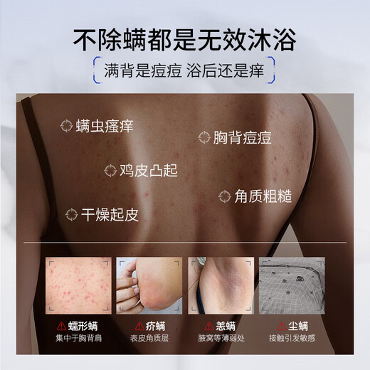 SUMDOY Japanese imported fruit acid shower gel removes mites, removes acne on the back, controls oil, relieves itching, moisturizes, and lasts for men and women. It is a great deal to remove mites every time, double cleansing, and care for the skin - two bottles