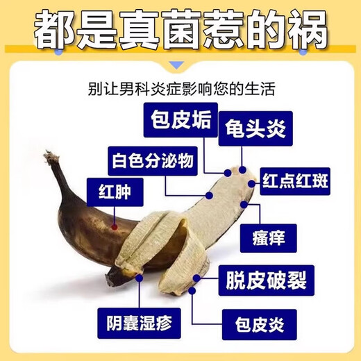 Erythromycin ointment, special medicine for balanitis to treat glans inflammation caused by candida infection, glans red spot preposthitis, candida mold, male private parts antibacterial ointment, 1 box, sterilization and itching, antibacterial and anti-inflammatory