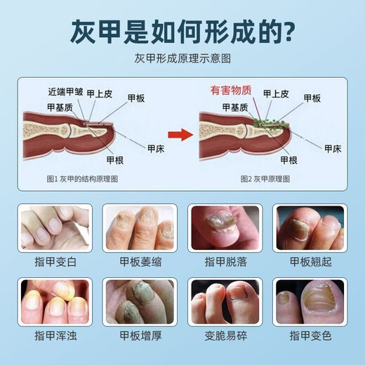 Makeup Deer Gray Nail Grinder Electric Nail Grinder Remover Trimmer Remove Dead Skin Nail File Gray Thick Nail Tool