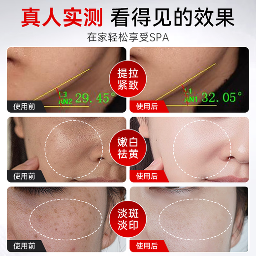 Ou Quanlin Milk Light Beauty Instrument Home Facial Photon Rejuvenation Instrument Blemish Removal Instrument Facial Whitening, Lifting and Firming Instrument Ultra-light Cannon MAX Milk Light + Micro Current Free Luxury Gift Package