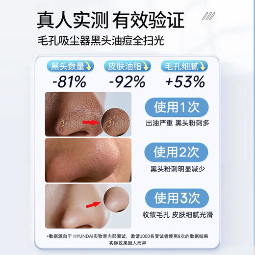 HYUNDAI Korean small bubble blackhead suction device electric large suction beauty salon men and women special blackhead suction device cleaning artifact New Year's Day holiday gift for male and female friends Top model - oxygenated water circulation - replenishing water while sucking - sparkling water