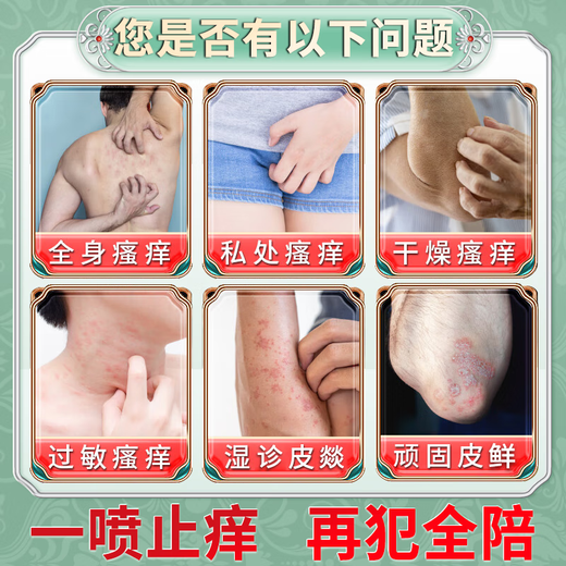 Peking Union Medical College, anti-itch, anti-bacterial, skin itching, body itch relief, 100% effective eczema, fungal infection, rash allergies, no recurrence, a box of Japanese anti-itch spray, no recurrence of eczema rash