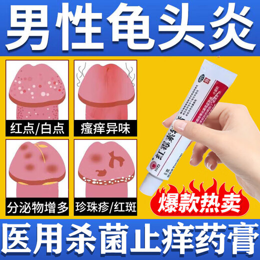 Erythromycin ointment, special medicine for balanitis to treat glans inflammation caused by candida infection, glans red spot preposthitis, candida mold, male private parts antibacterial ointment, 1 box, sterilization and itching, antibacterial and anti-inflammatory