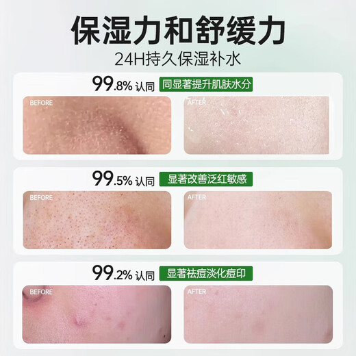 DAGO Natural Aloe Vera Gel Hydrating, Moisturizing, Rejuvenating and Anti-Dermatitis 100% Non-Medical For Men and Women Only 300g