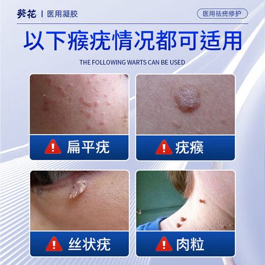 Sunflower wart exfoliation cream special for flat warts, filamentous condylomata acuminata, plantar warts, wart-type neck warts, fleshy granules 1 box (100% fast delivery)