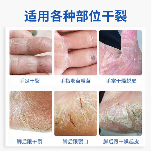 Wuyang Snake Ointment Hand Cream Vaseline Hand Mask Dry and Rough Anti-Cracked Foot Cream Dry and Cracked Heels