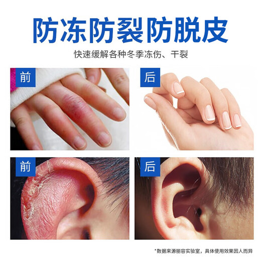 Wuyang Snake Ointment Hand Cream Vaseline Hand Mask Dry and Rough Anti-Cracked Foot Cream Dry and Cracked Heels