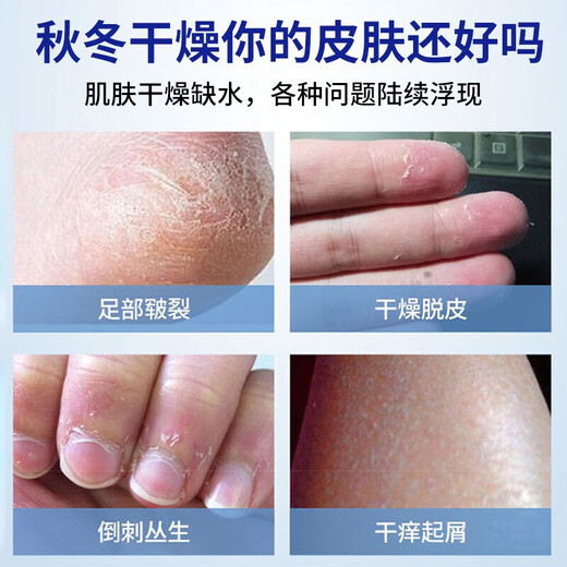 Baicuilai cracking 85g Vaseline hand cream to prevent dry cracking of hands, feet and heels, non-medical genuine anti-cracking cream